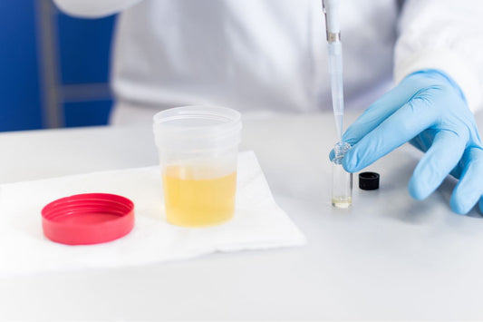 Um médico analisa uma amostra de urina